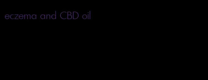 eczema and CBD oil